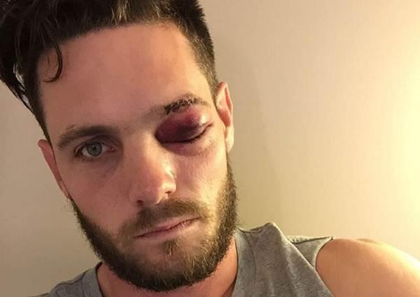 Mitchell Mcclenaghan (Photo Source: Twitter) Cricketing trends